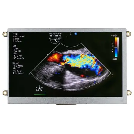 Produktfoto 1 von NEWHAVEN DISPLAY INTERNATIONAL TFT-LCD-Anzeige 7 Zoll HDMI Touchscreen Kapazitiv, 800 x 480 Pixel, 156.7 x 89.1 mm LED